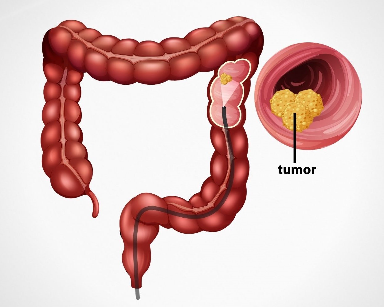 Colonoscopy facility