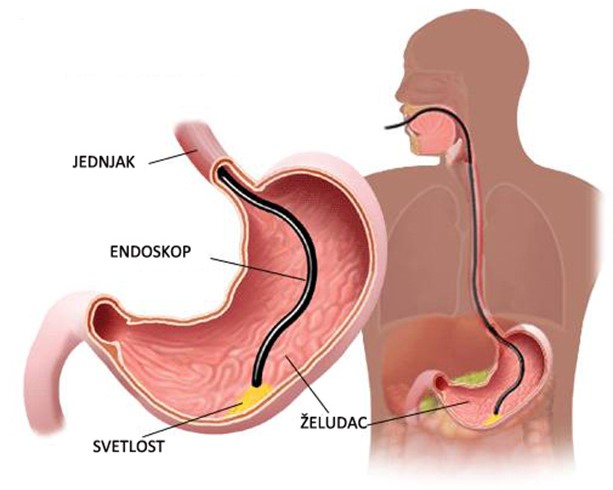 UGI endoscopy facility