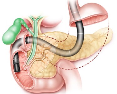 ERCP facility